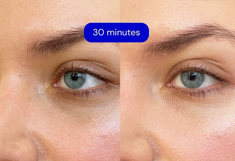 Eye Therapy Patch