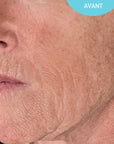 Anti-Aging Serum
