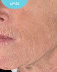 Anti-Aging Serum
