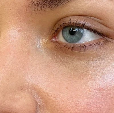 Eye Therapy Patch — avant