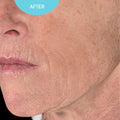 Serum Anti-Aging